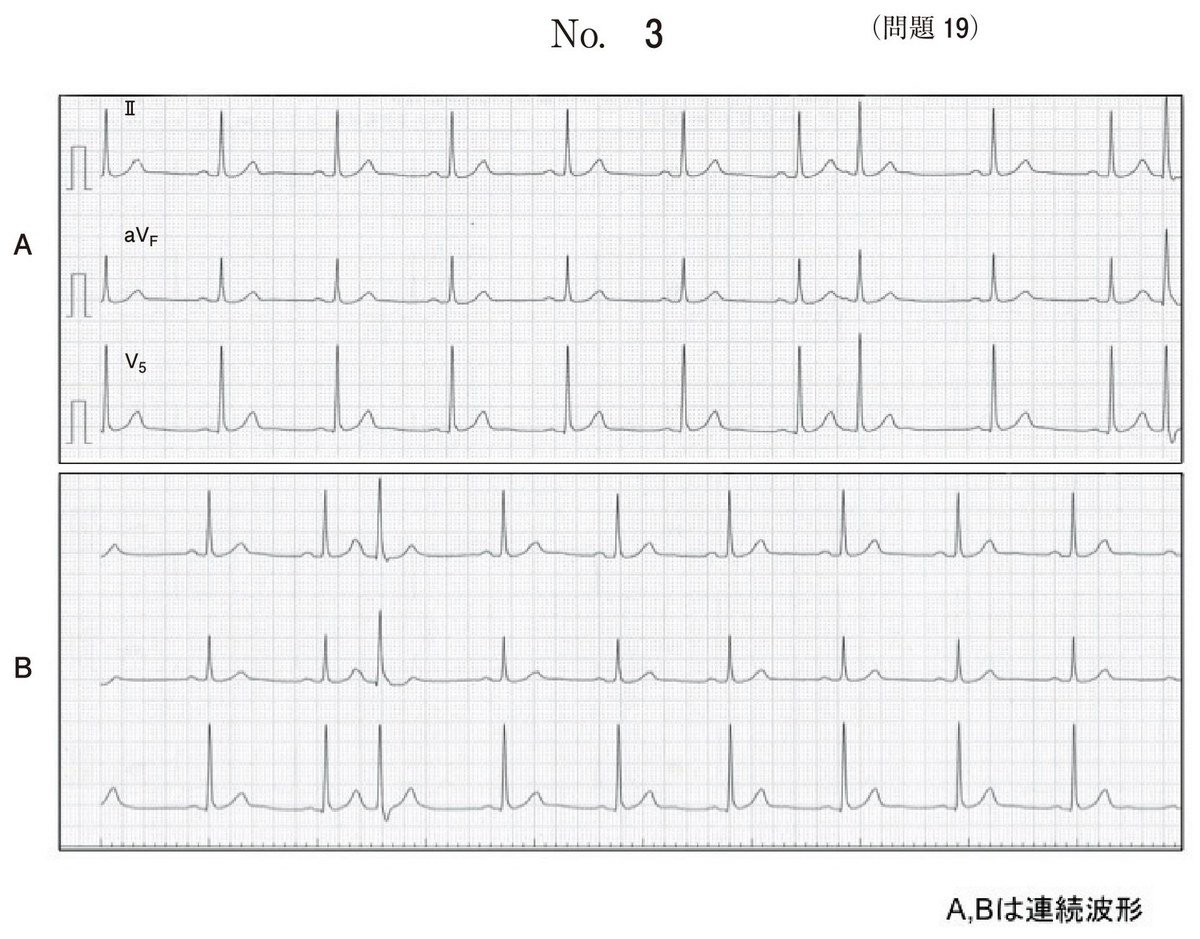 第58回 午後19 の図