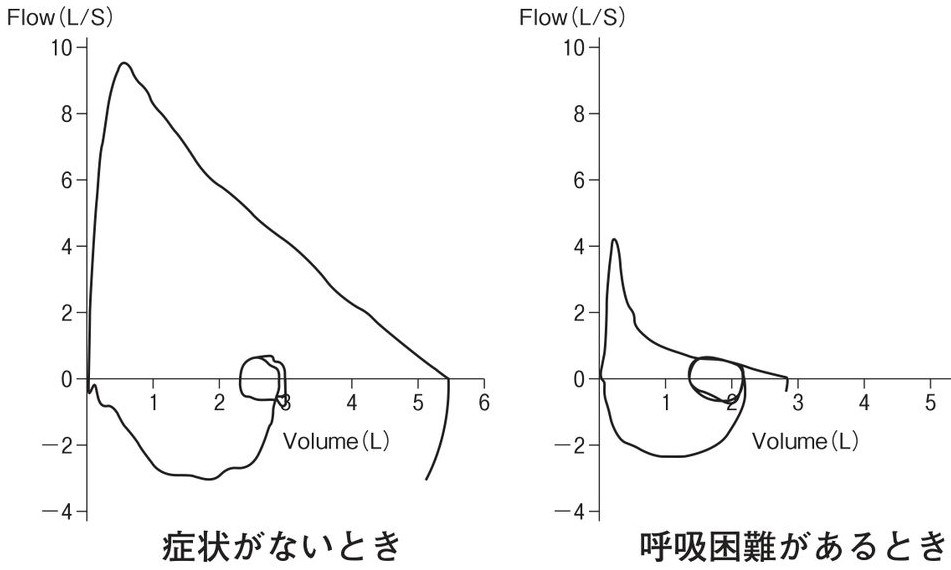 第58回 午後22 の図