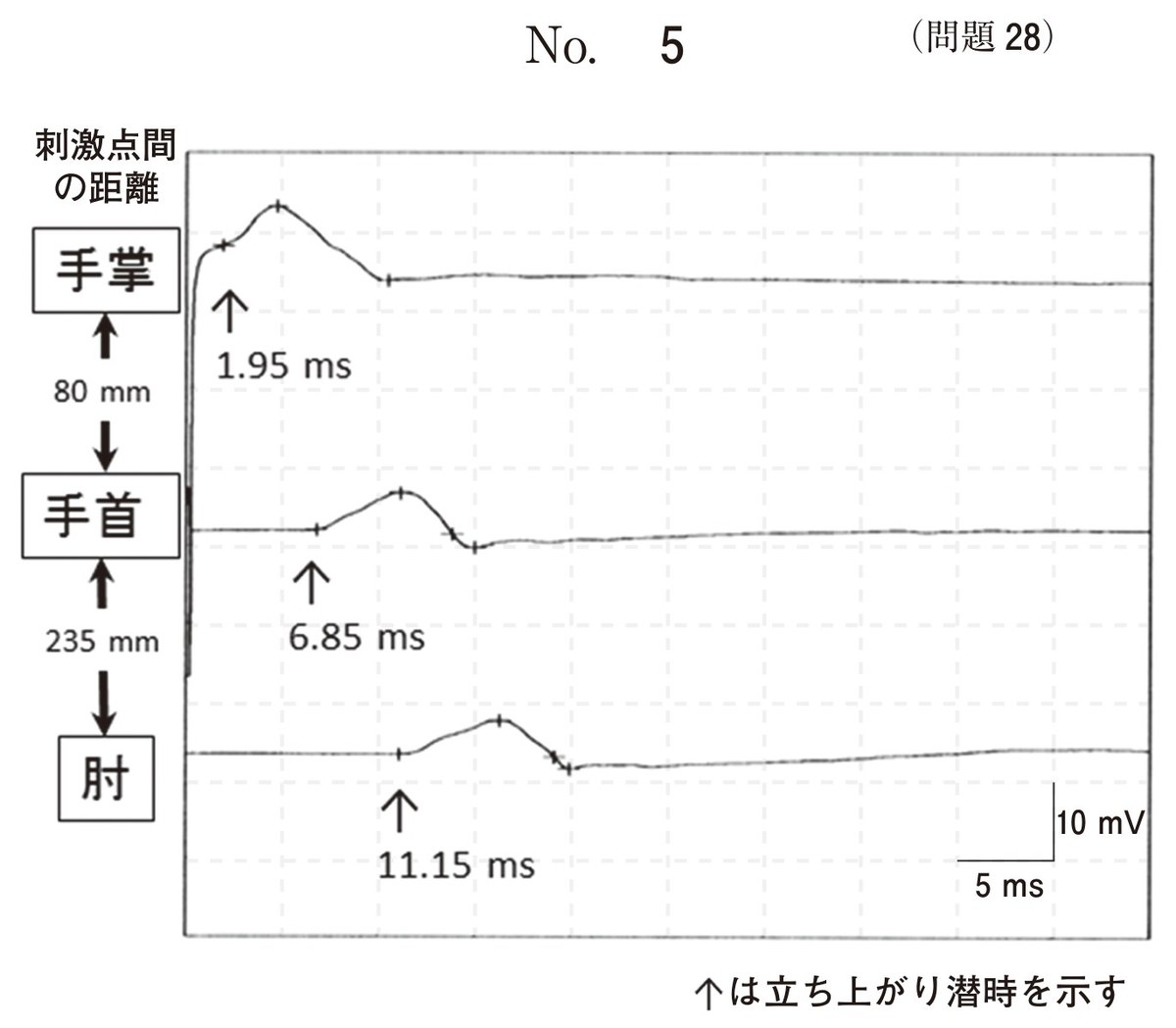 第61回 午後28 の図