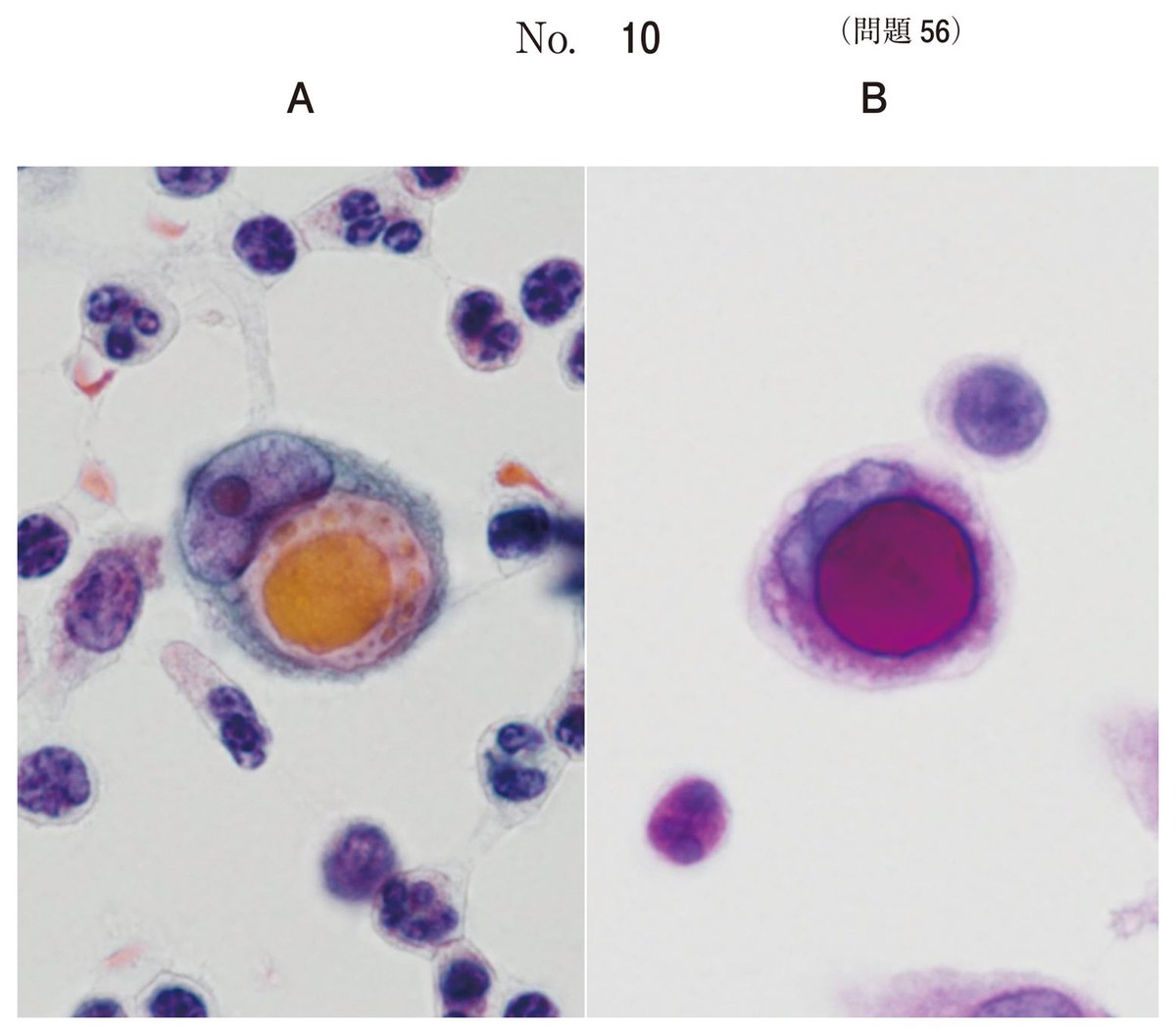 第61回 午後56 の図