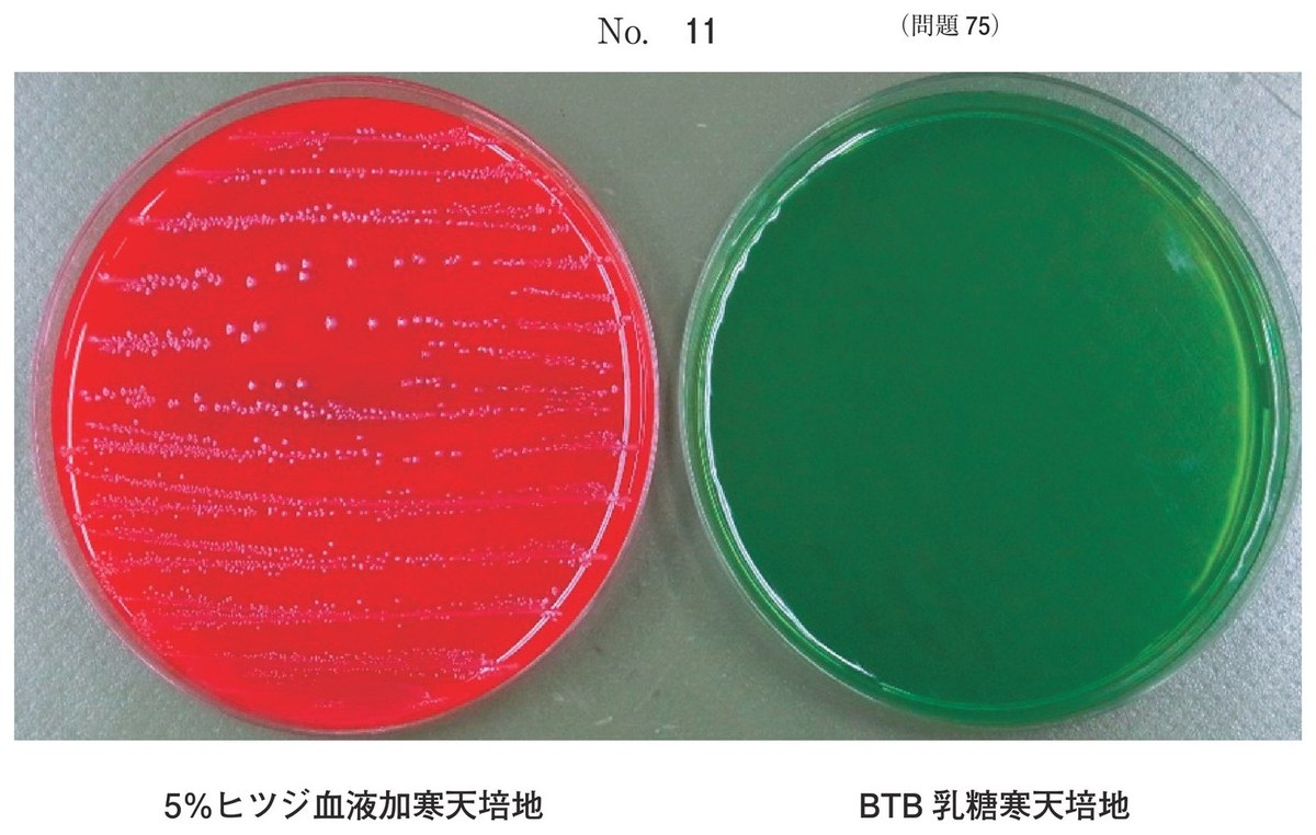 第62回 午後75 の図