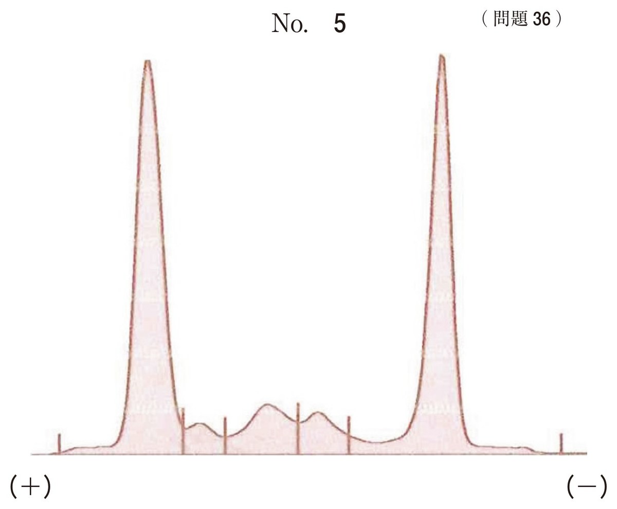第66回 午前36 の図