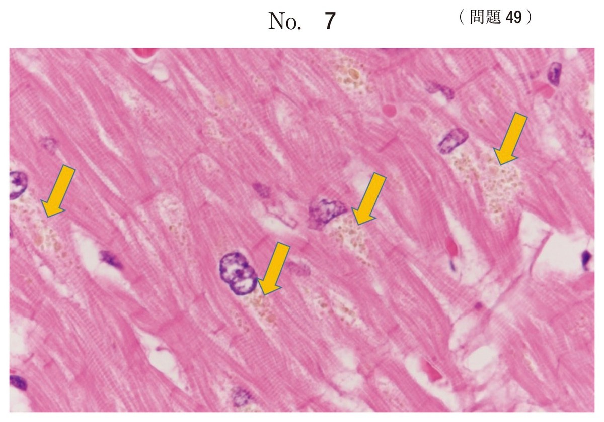 第66回 午前49 の図