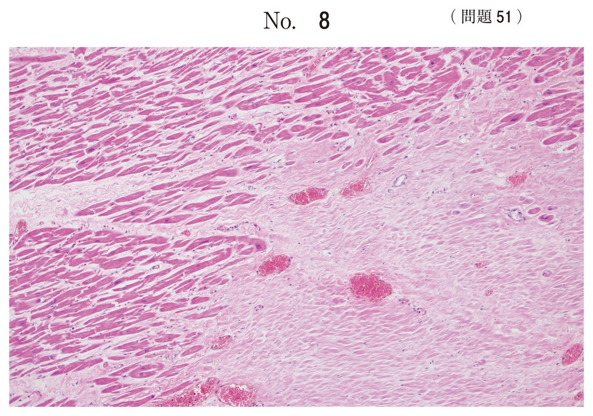 第66回 午前51 の図