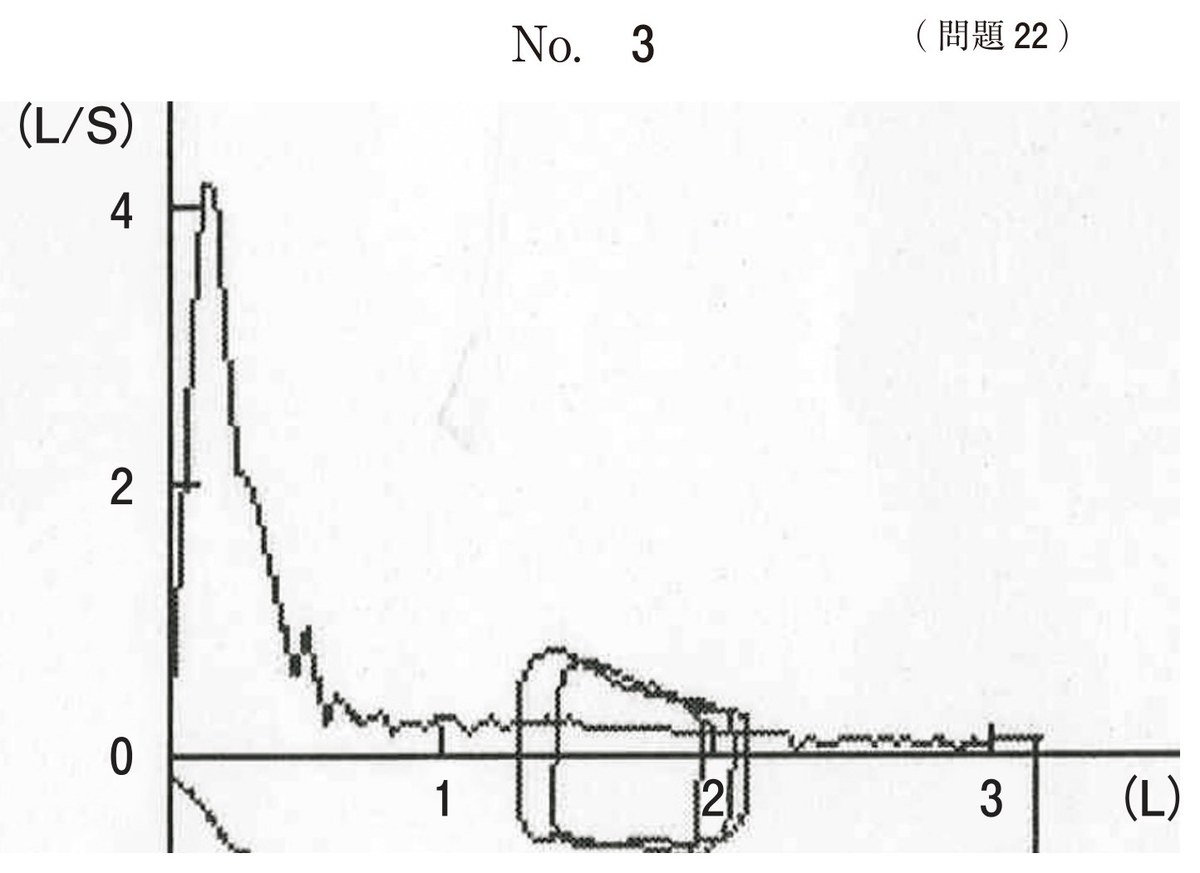 第67回 午後22 の図