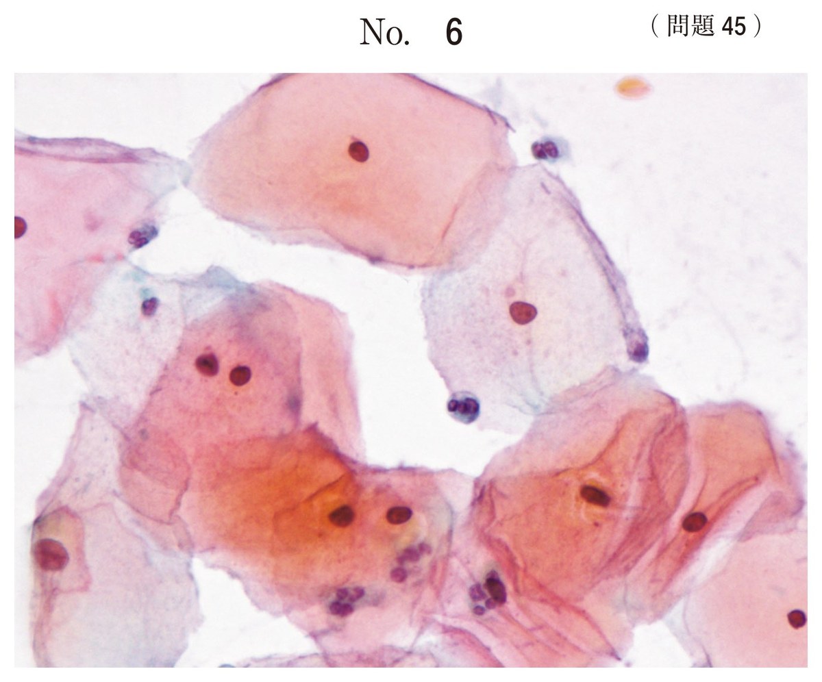 第67回 午後45 の図