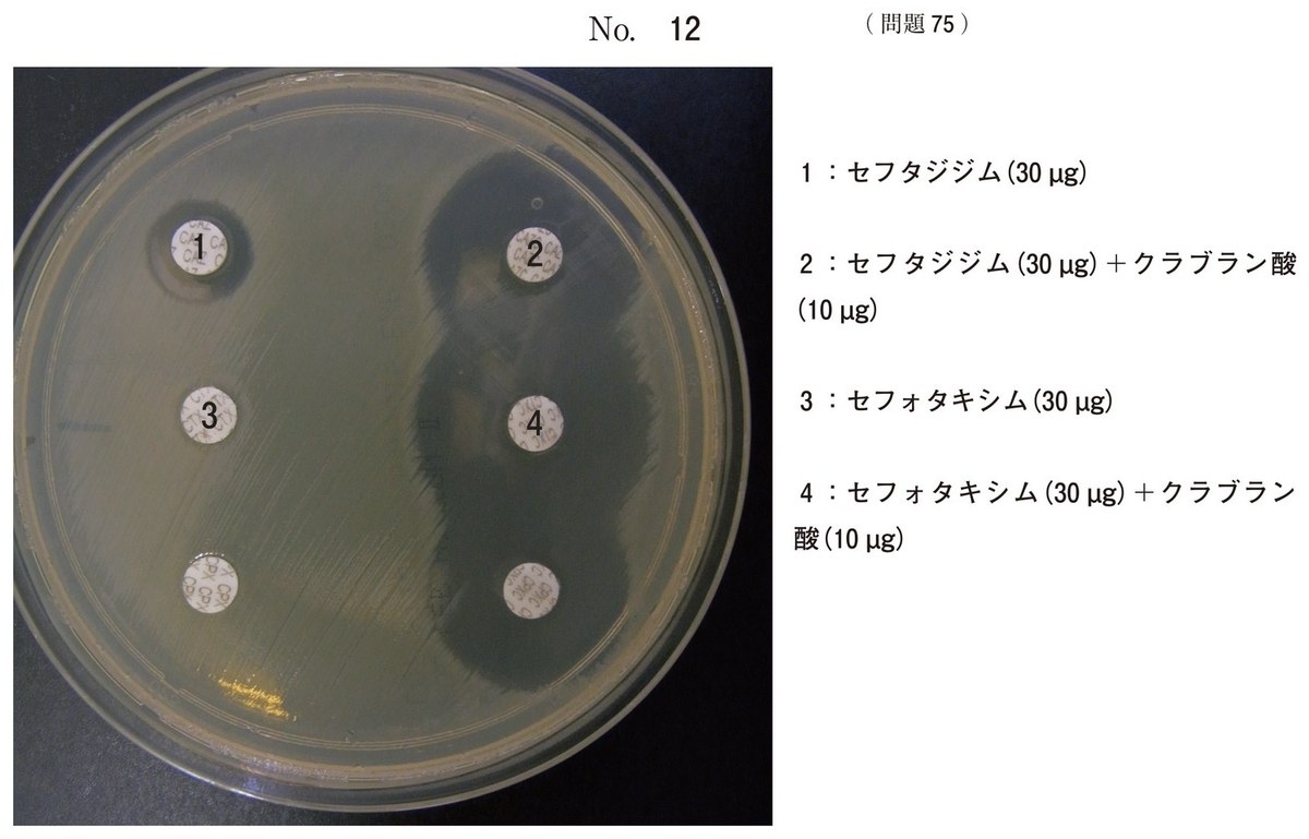 第67回 午後75 の図