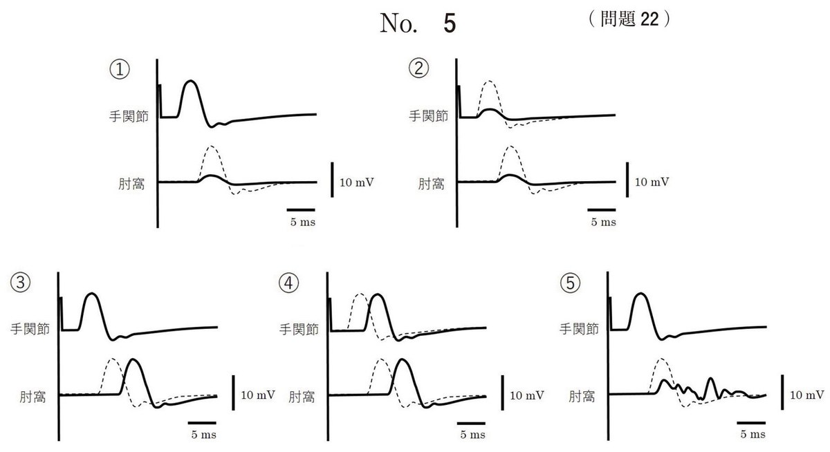 第68回 午前22 の図