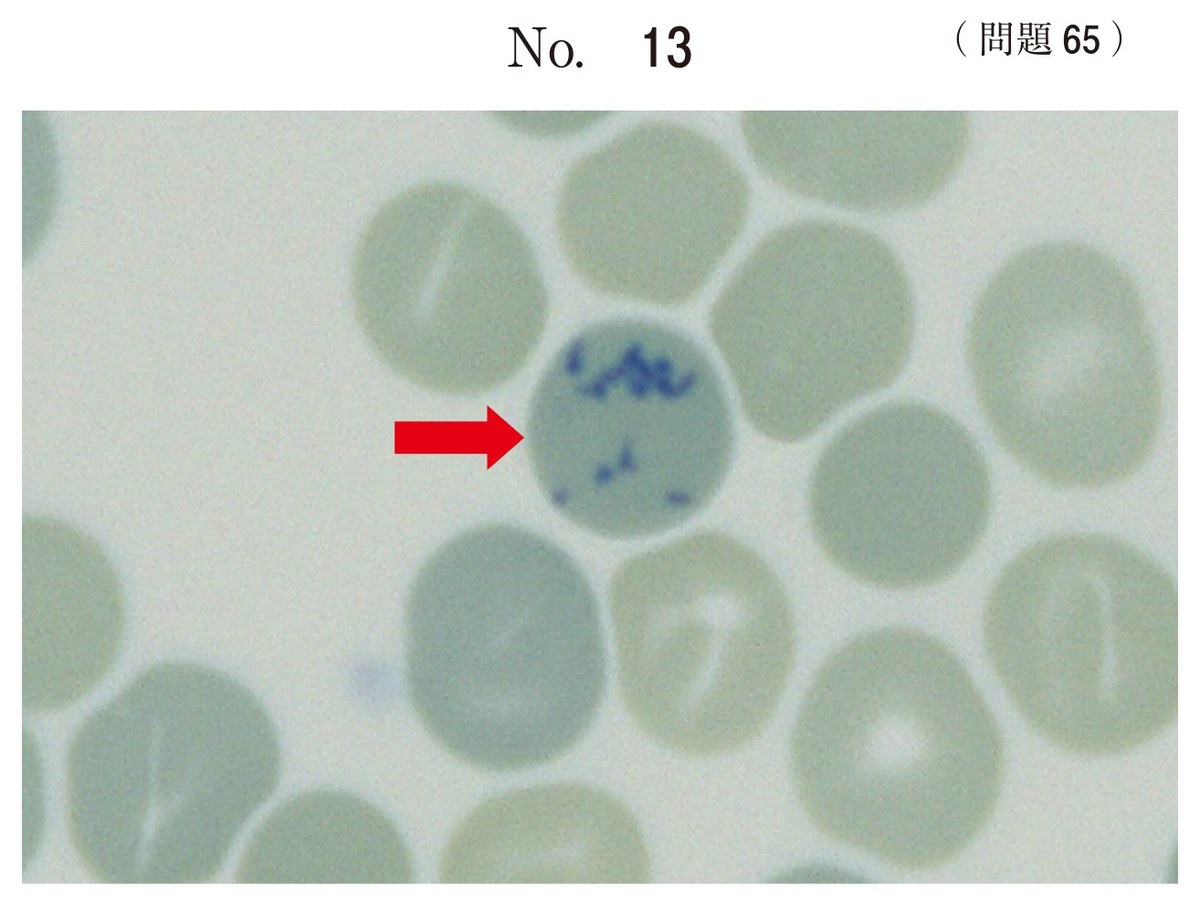 第68回 午前65 の図