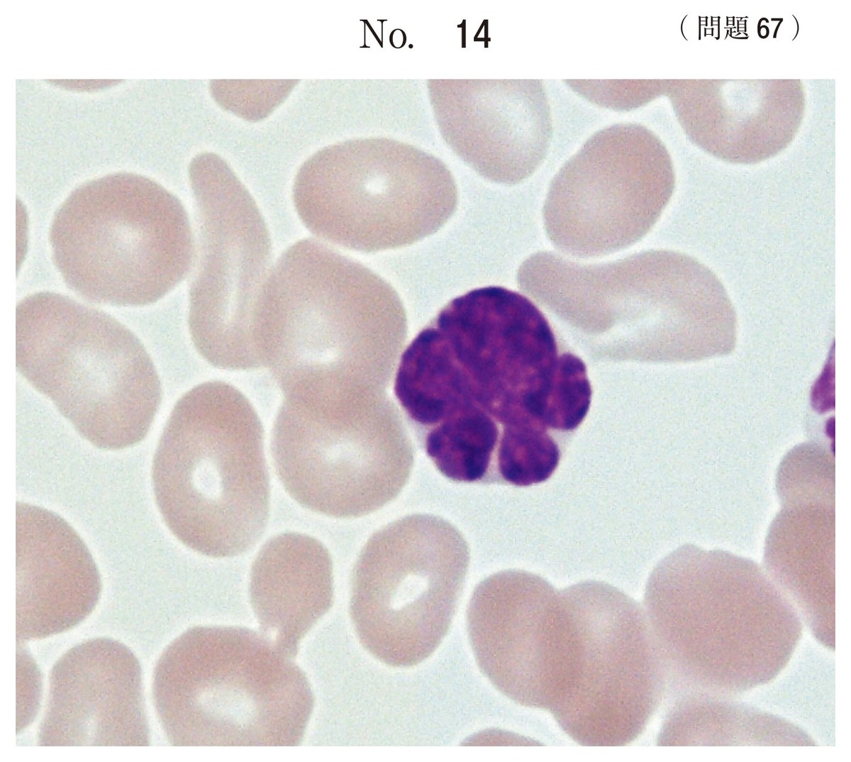 第68回 午前67 の図