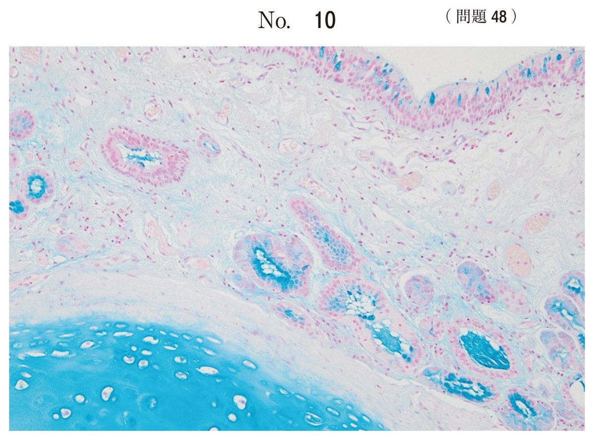 第69回 午前48 の図
