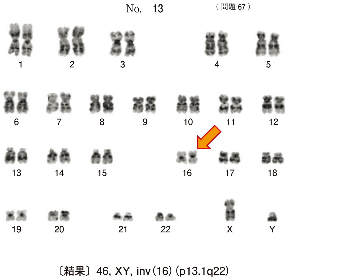 第70回 午前67 の図