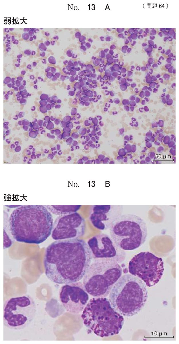 第71回 午後64 の図