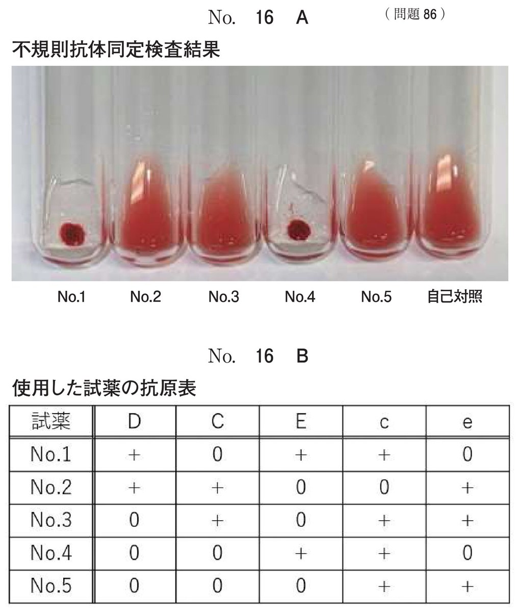 第71回 午後86 の図