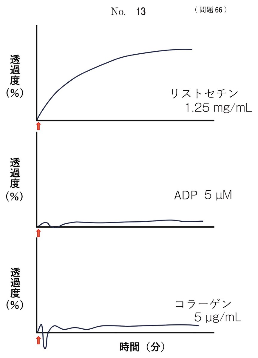 第72回 午前66 の図