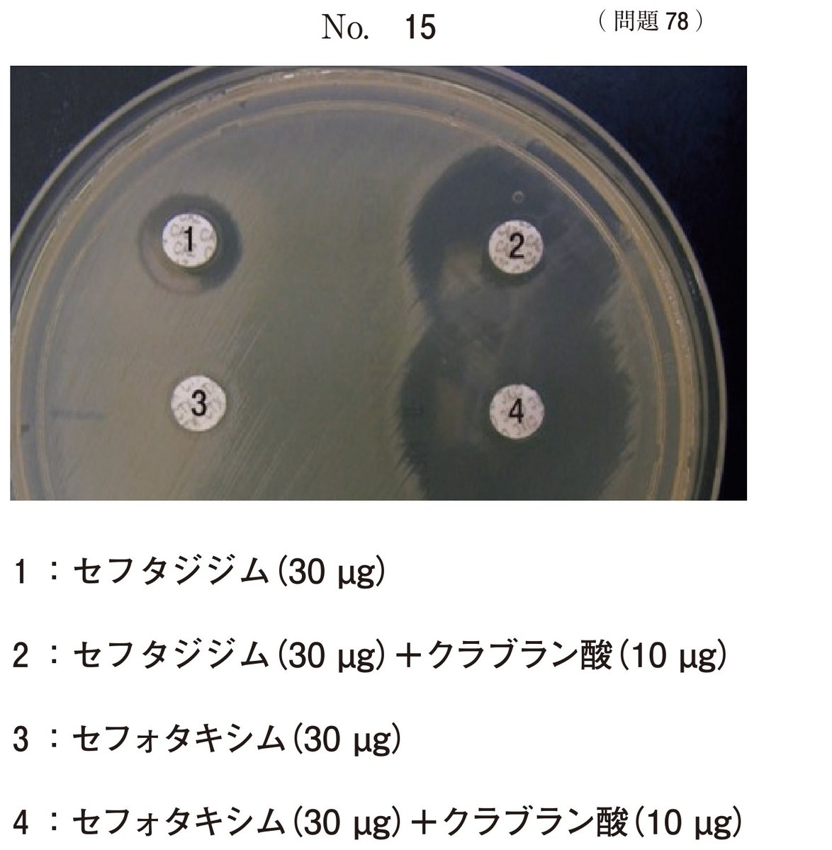 第72回 午前78 の図