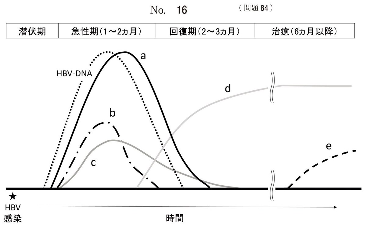 第72回 午前84 の図